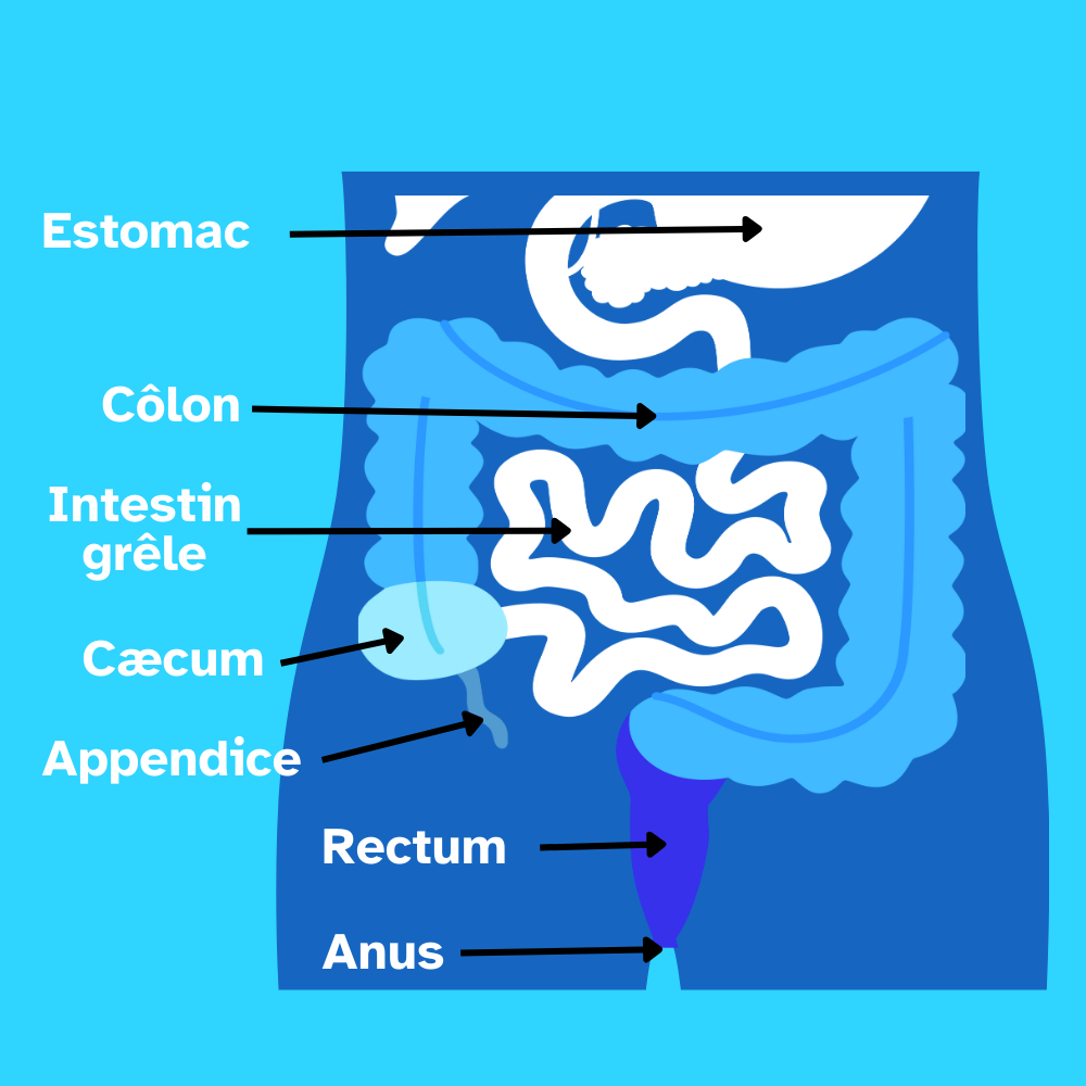 Cancer colorectal - ICPF